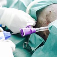 Chirurgia Mini-invasiva